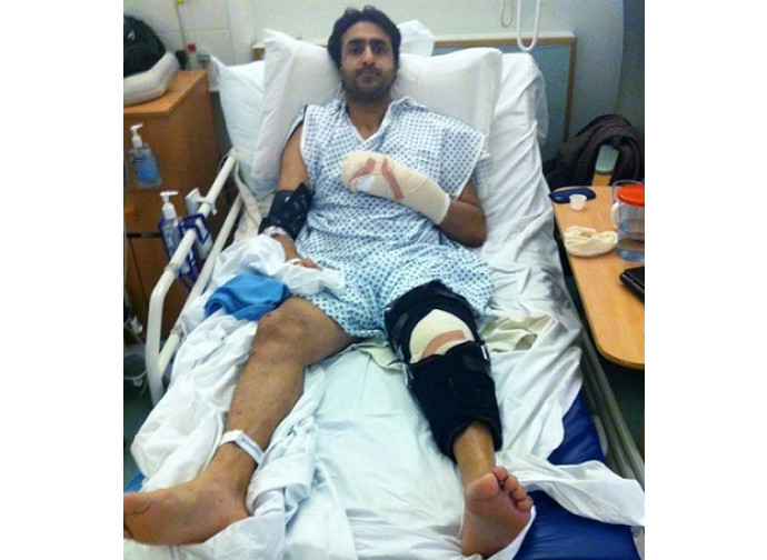 Nissar Hussain dopo l'aggressione subita