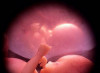 USA, Corte d’Appello stoppa pillole abortive via posta