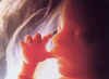 73 milioni di vittime nel 2024: l’aborto prima causa di morte al mondo