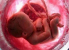 Nuovo movimento pro vita: “No all’uso di cellule fetali”