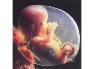 Cara Associazione Coscioni, l'embrione è una persona