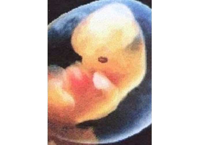 Embrione umano