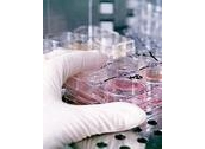 Fecondazione in vitro