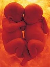 La prima carezza tra gemelli 
è già nell'utero