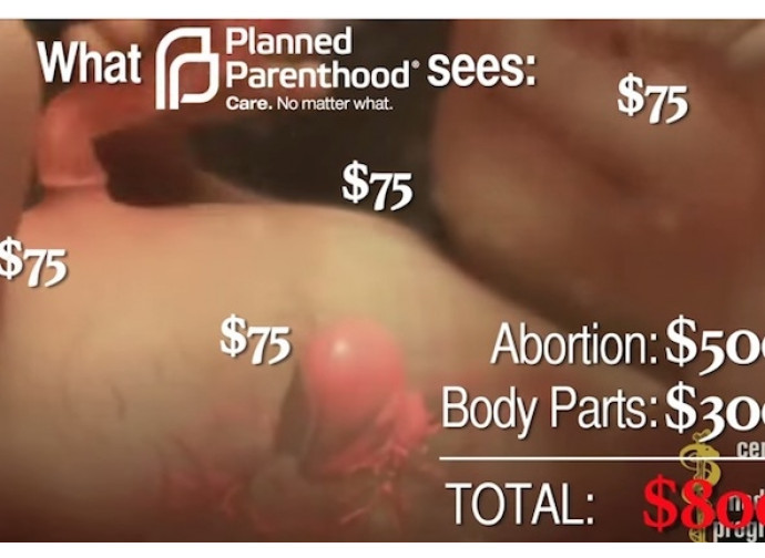Il tariffario dell'orrore dei feti abortiti